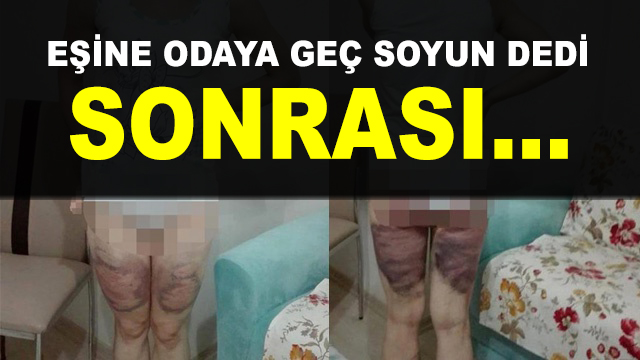 Eşine Odaya Geç ve Soyun Dedi, Sonrası Tam Bir Dehşet